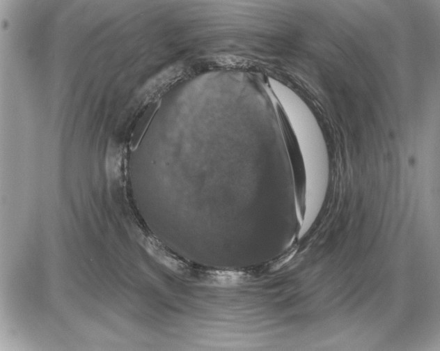 X0000085770233200704131811