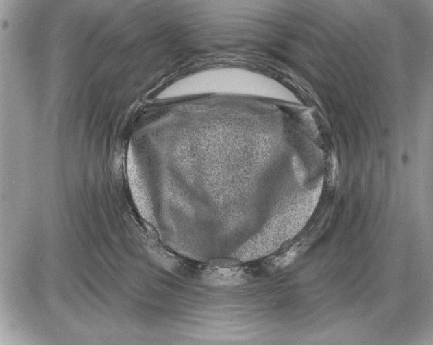 X0000085770329200704131810