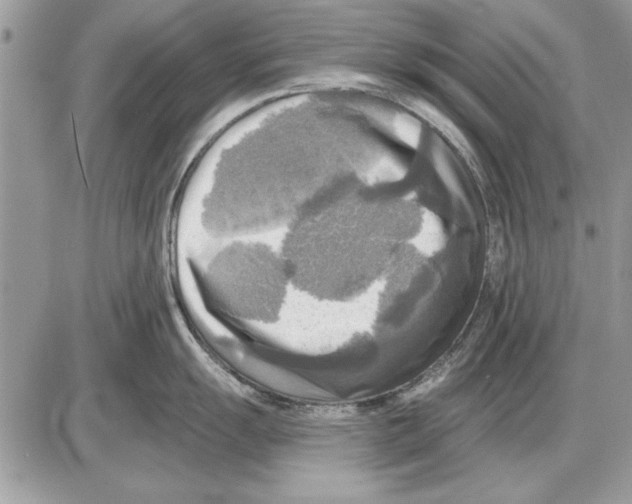 X0000085771055200704131758