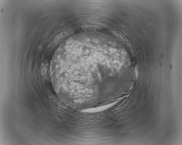 X0000085771059200704131758