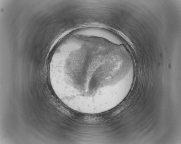 X0000085771364200704131753