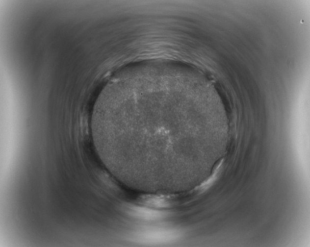 X0000085780182200703161214