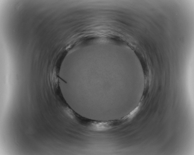 X0000085780186200703161214