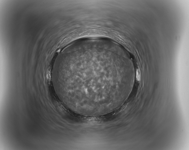 X0000085781155200703161158