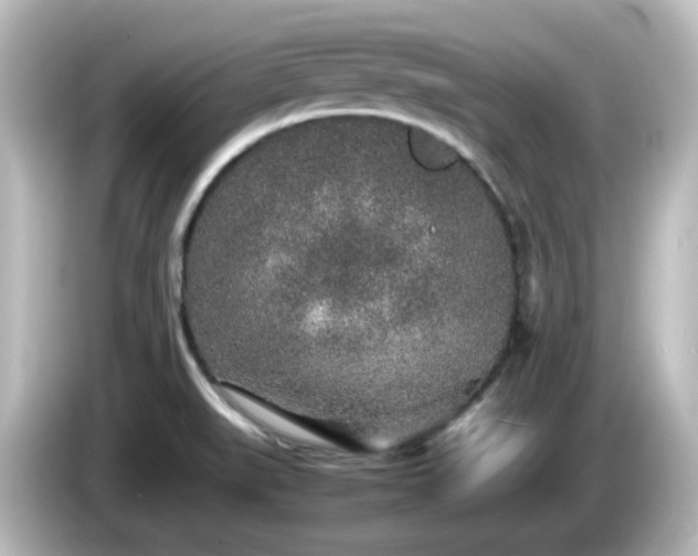 X0000085781519200703161154