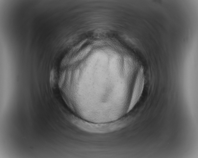 X0000085780038200703301435