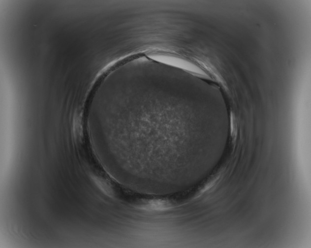 X0000085780204200703301432