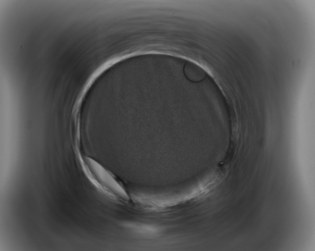 X0000085781515200703301414