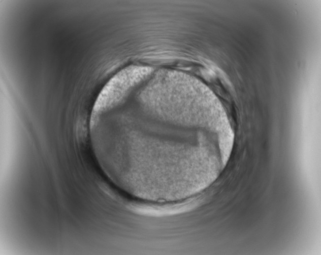 X0000085780017200704091420