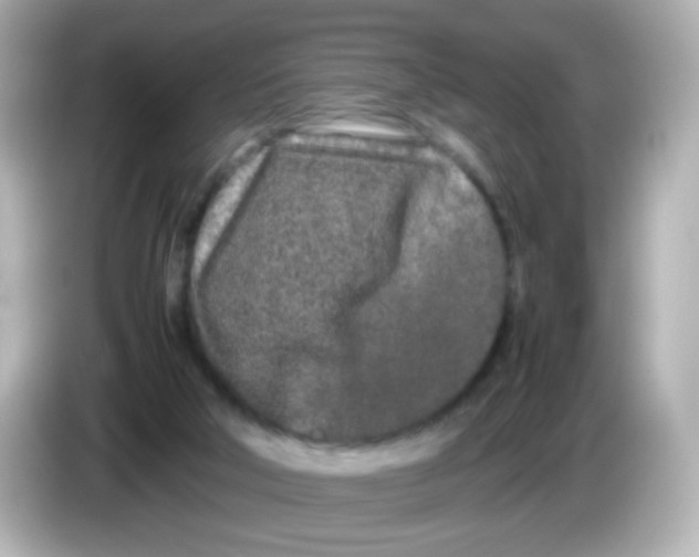 X0000085780018200704091420