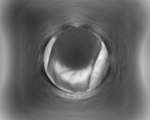 X0000085780043200704091420