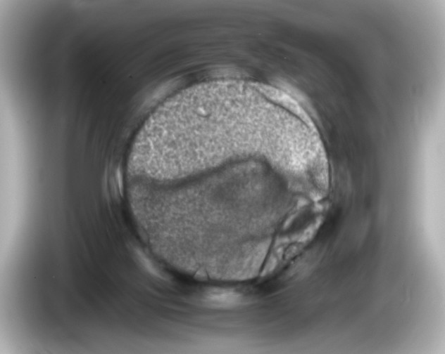 X0000085780061200704091419