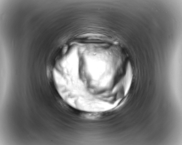 X0000085780094200704091420