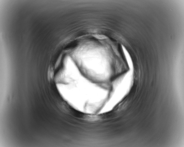 X0000085780095200704091420