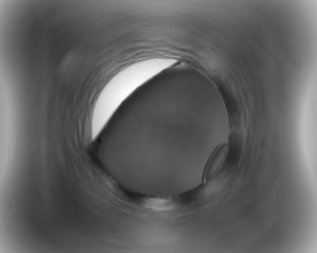 X0000085780139200704091418