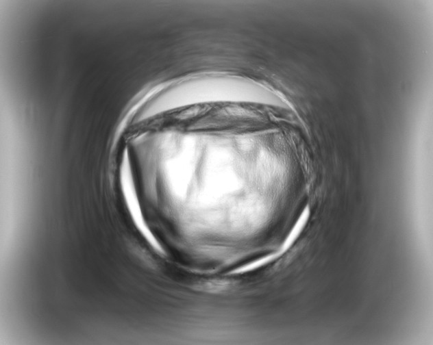 X0000085780152200704091418