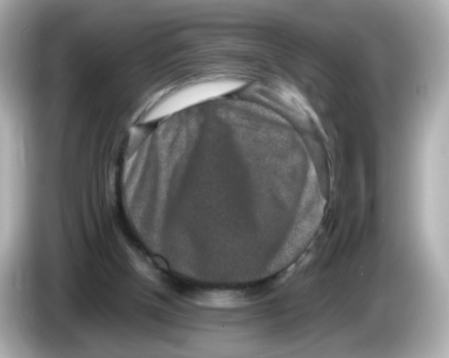 X0000085780154200704091418