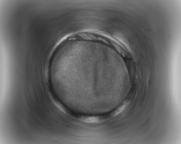 X0000085780156200704091418