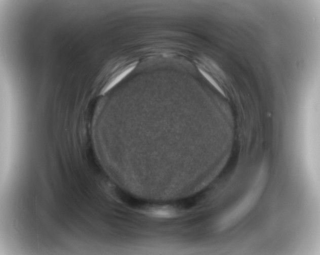 X0000085780169200704091418