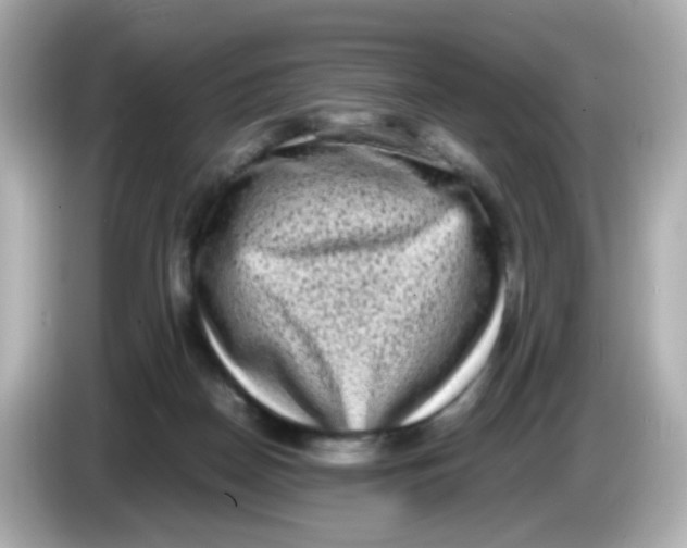 X0000085780170200704091418