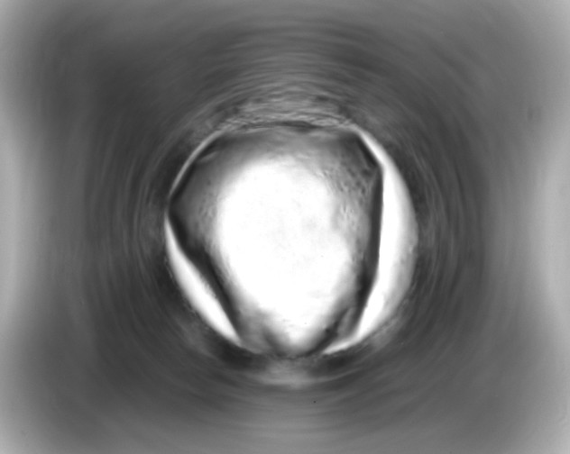 X0000085780178200704091418