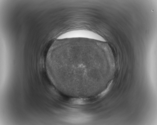 X0000085780182200704091418