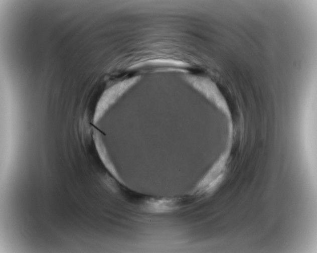 X0000085780186200704091418