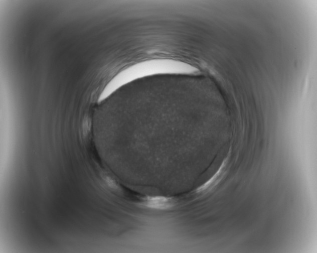 X0000085780192200704091418