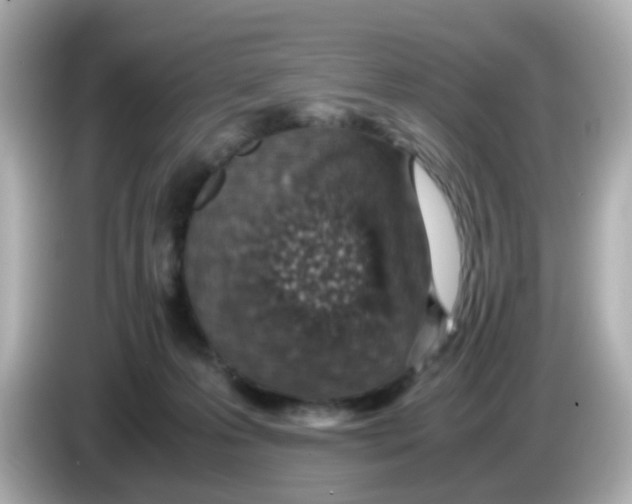 X0000085780223200704091417