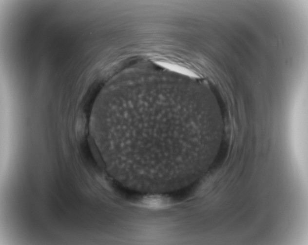 X0000085780231200704091417