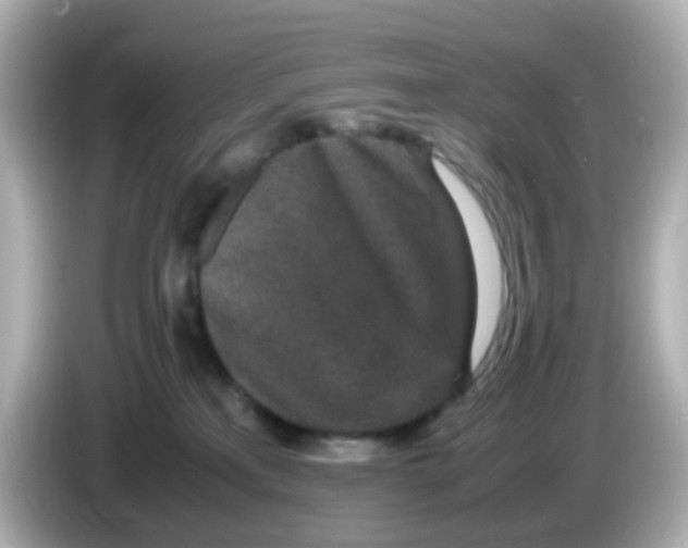 X0000085780233200704091417