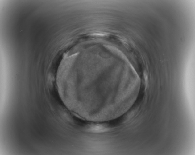 X0000085780235200704091417