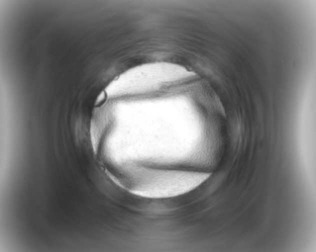 X0000085780236200704091417