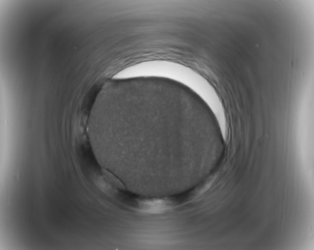 X0000085780237200704091417