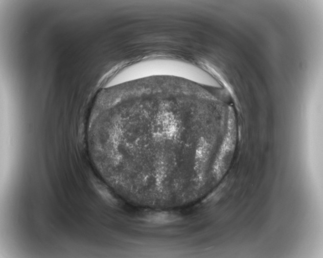 X0000085780249200704091417