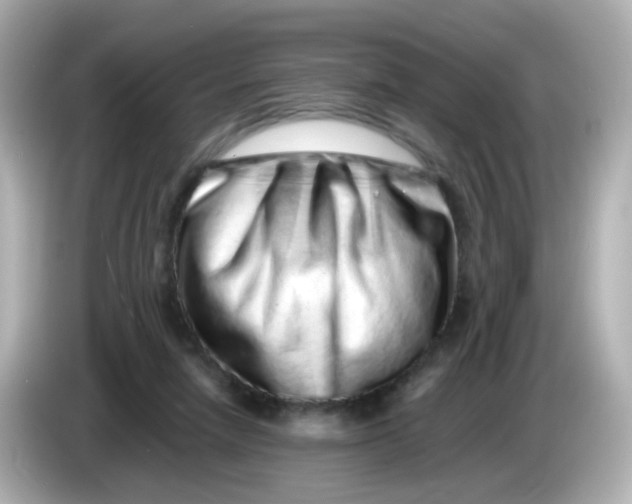 X0000085780258200704091417