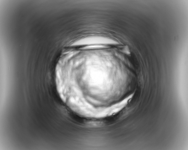 X0000085780270200704091417