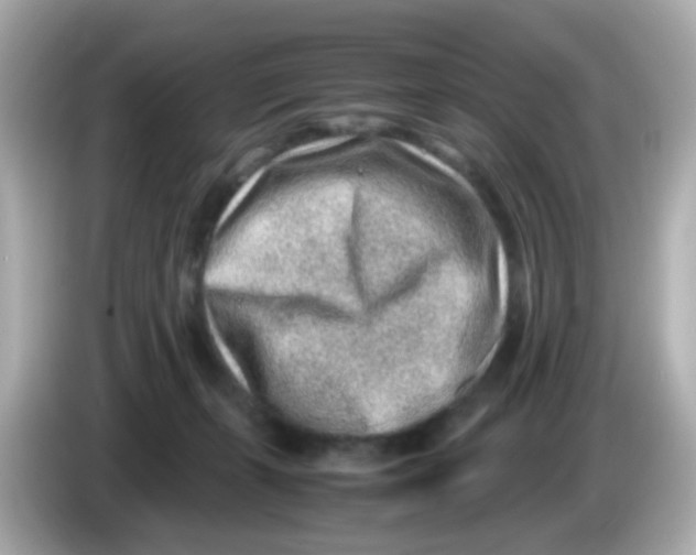 X0000085780271200704091417