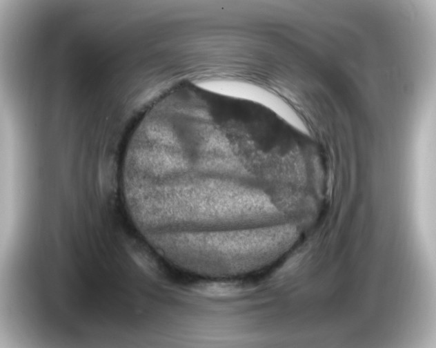 X0000085780303200704091417