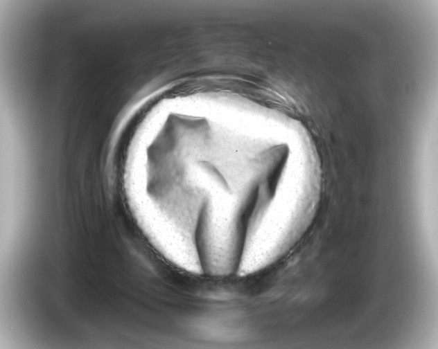 X0000085780343200704091416