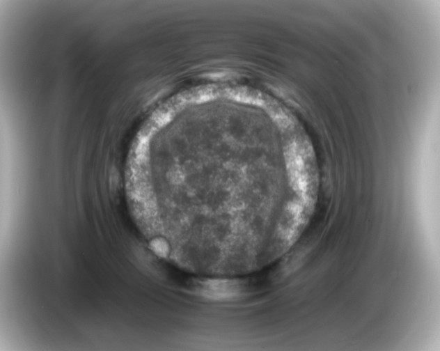 X0000085780371200704091416