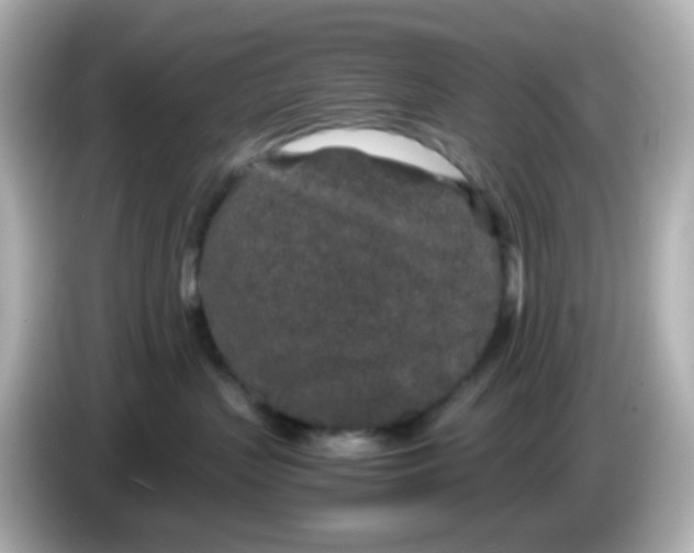 X0000085780383200704091416