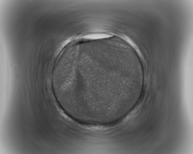 X0000085780385200704091416