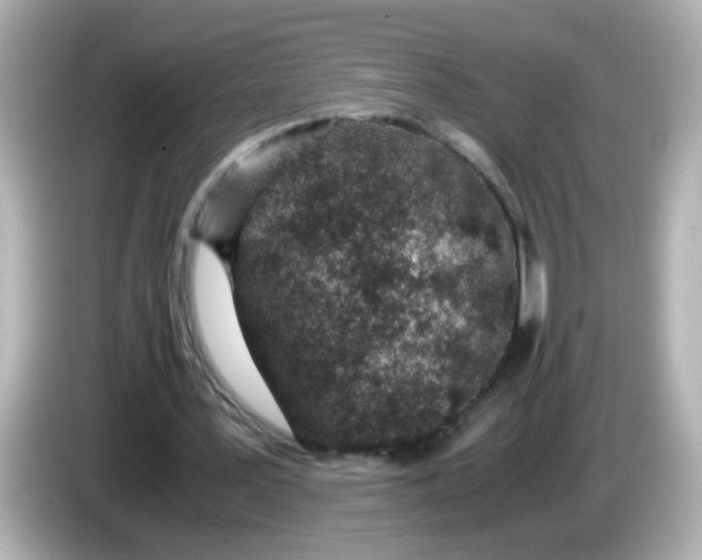 X0000085780387200704091416