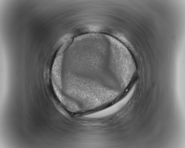 X0000085780397200704091415