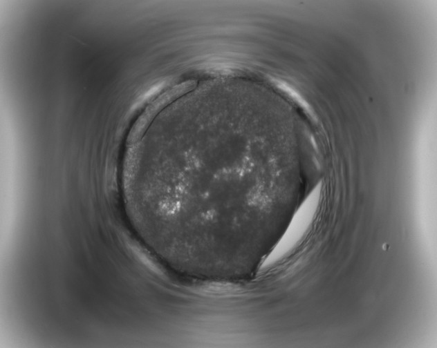 X0000085780399200704091415