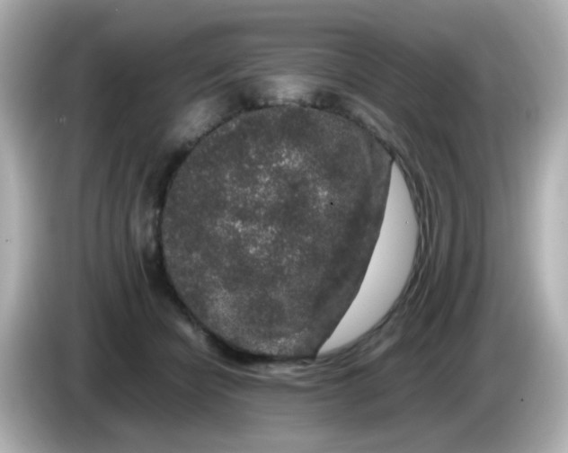 X0000085780462200704091415