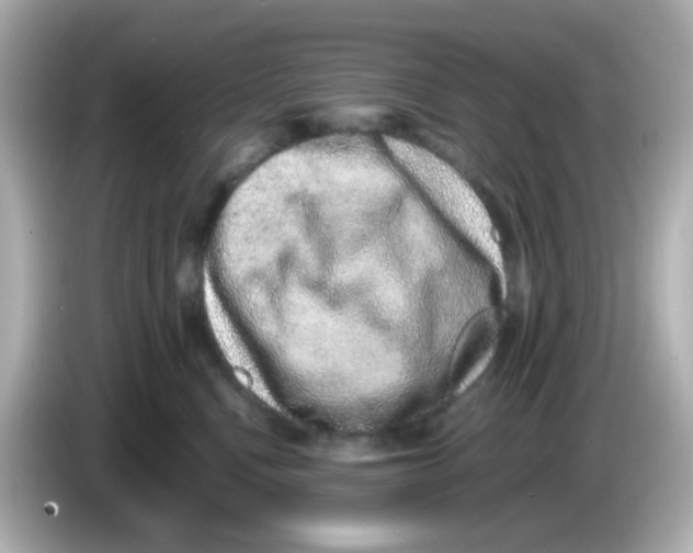 X0000085780472200704091415