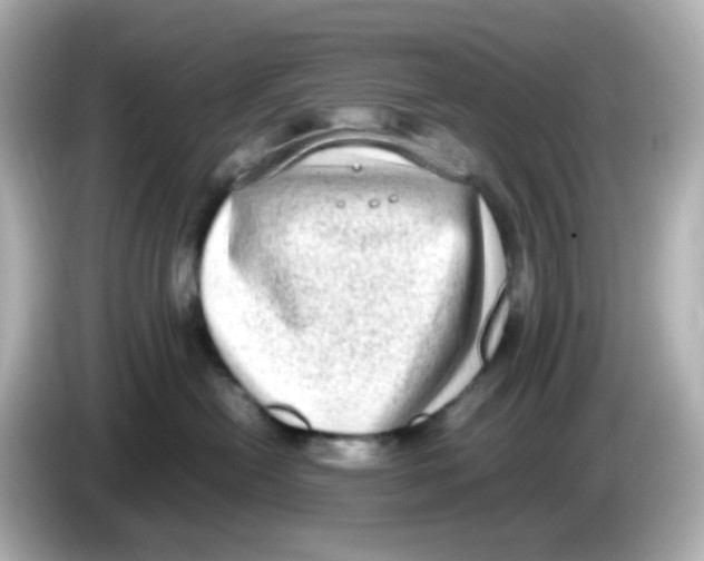 X0000085780478200704091415