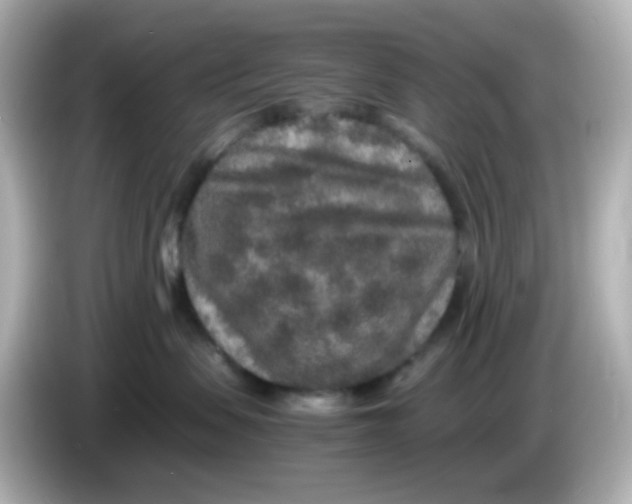 X0000085780479200704091415